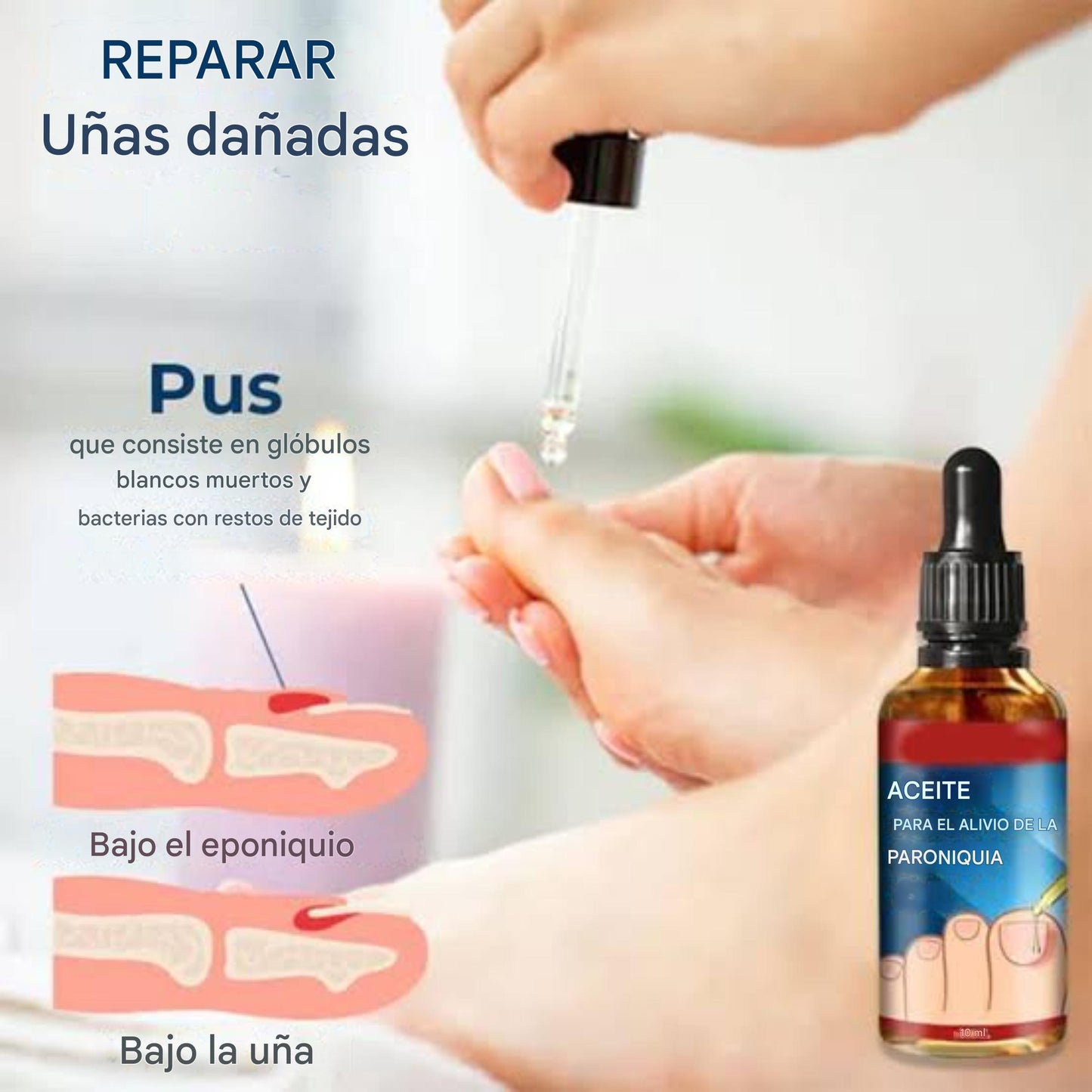 Anti Hongos para Uñas